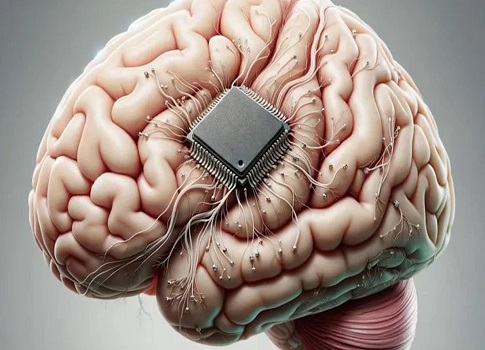 «آبل» تختبر التحكّم بالأجهزة عبر شرائح دماغية
